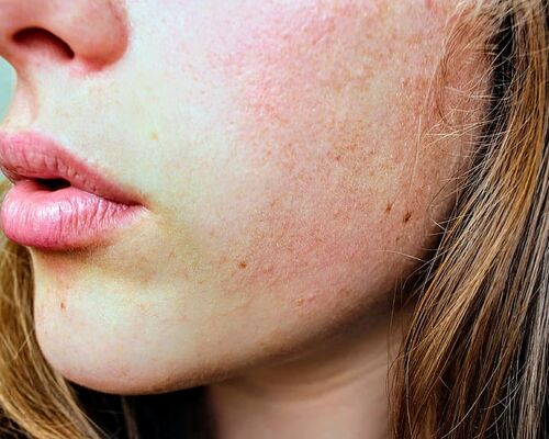 hair-human-pose-skin