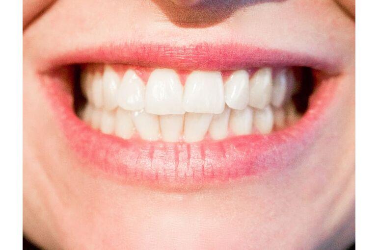 teeth-dentist-dental-mouth