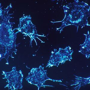 cancer-cells-cells-scan-electron-microscope-scan