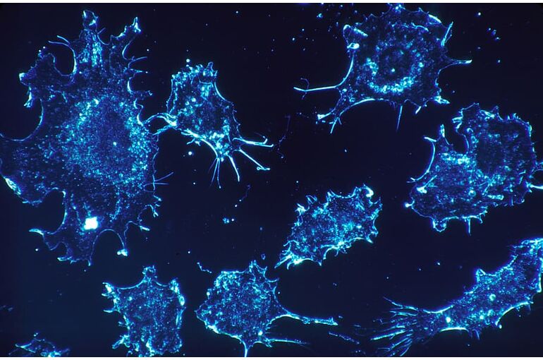 cancer-cells-cells-scan-electron-microscope-scan